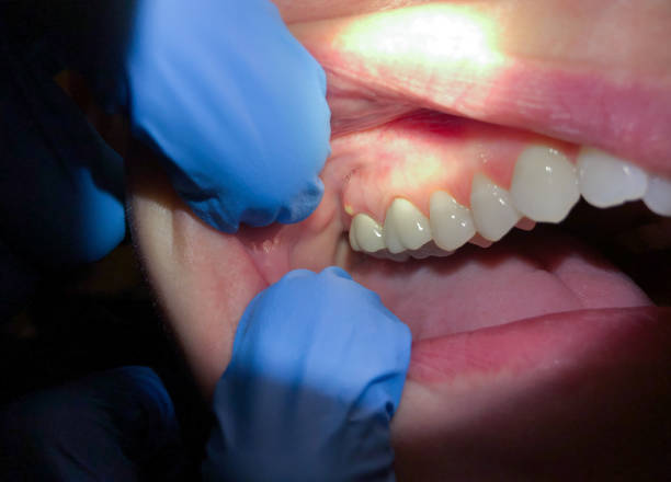 Best Urgent Dental Care in Spearville, KS